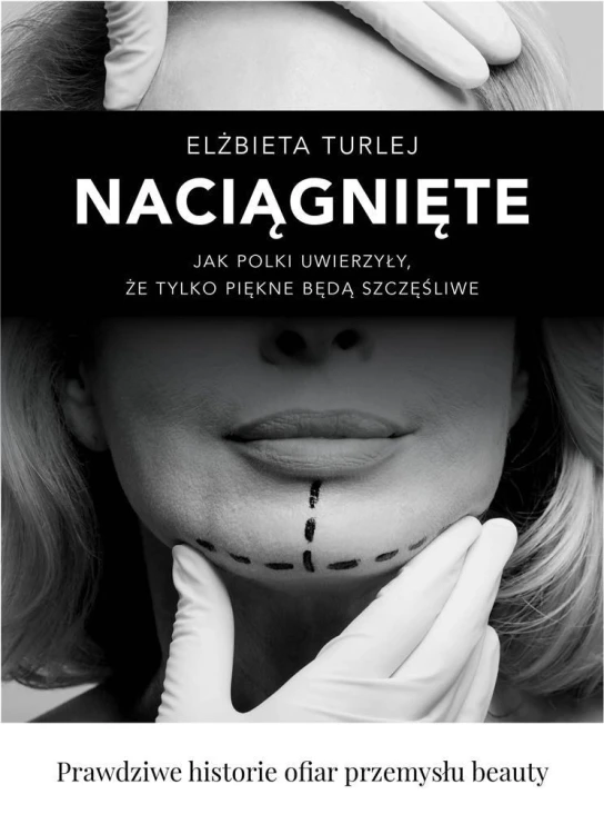 Naciągnięte, Elżbieta Turlej