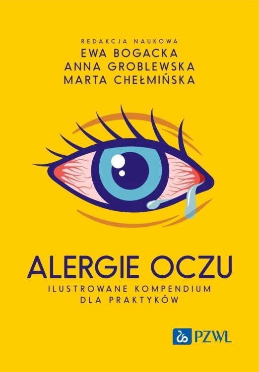 Alergie oczu. Ilustrowane kompendium dla praktyków