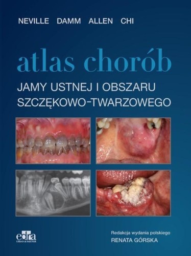 Atlas chorób jamy ustnej i obszaru szczękowo..