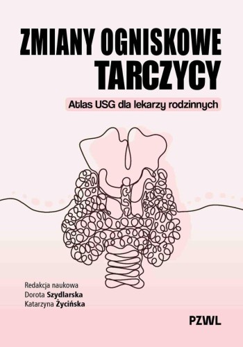Zmiany ogniskowe tarczycy. Atlas USG dla lekarzy..
