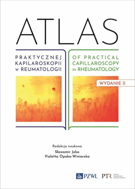Atlas praktycznej kapilaroskopii w reumatologii